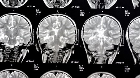 The Physiological Transformation: The Design in the Mother's Brain